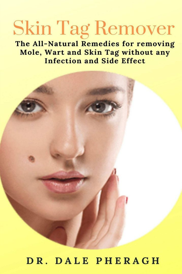 Skin Tag Remover. The All-Natural Remedies for removing Mole, Wart and Skin Tag without any Infec...