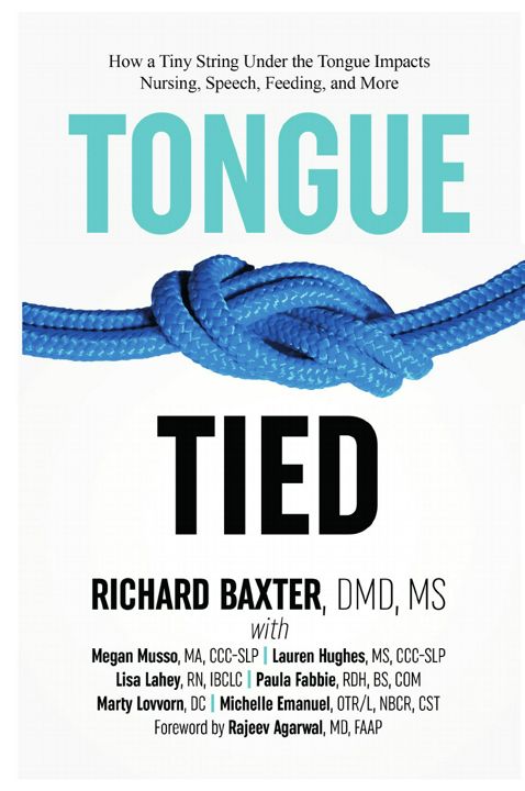 Tongue-Tied. How a Tiny String Under the Tongue Impacts Nursing, Speech, Feeding, and More