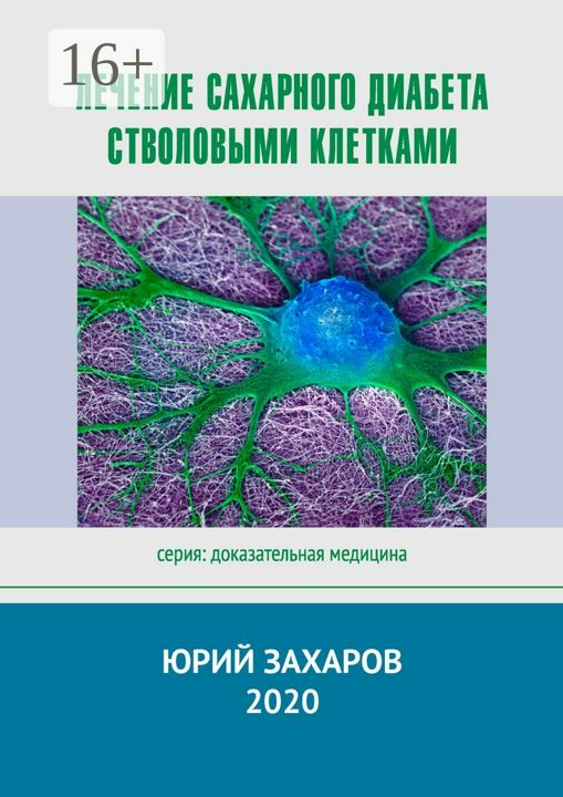 Лечение сахарного диабета стволовыми клетками