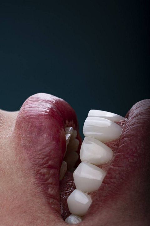 30 готовых постов для стоматолога по отбеливанию зубов